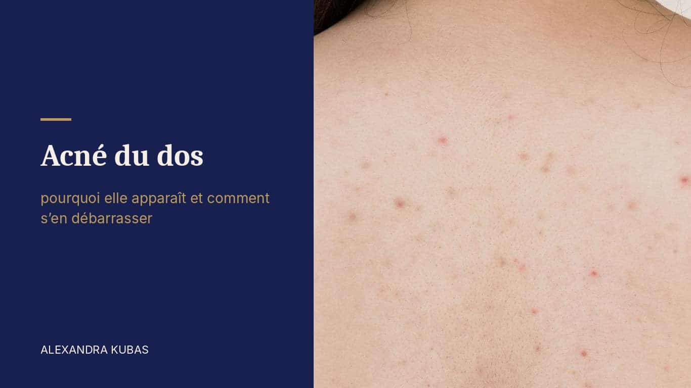 Acné du dos - boutons et marques sur le dos