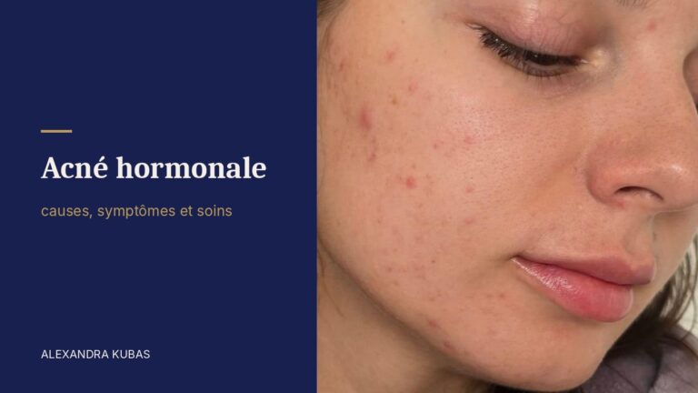 Acné hormonale - boutons sur la joue et la mâchoire