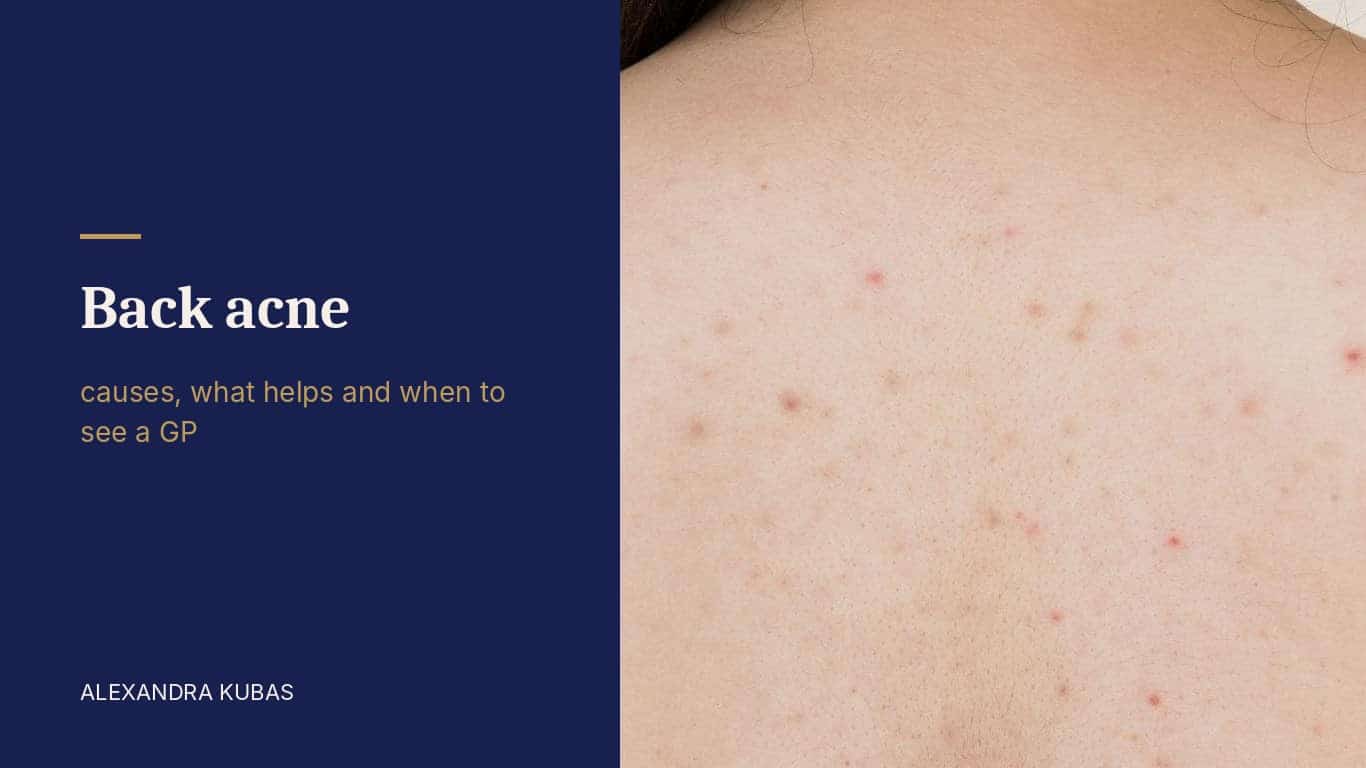Back acne - spots and marks on the back