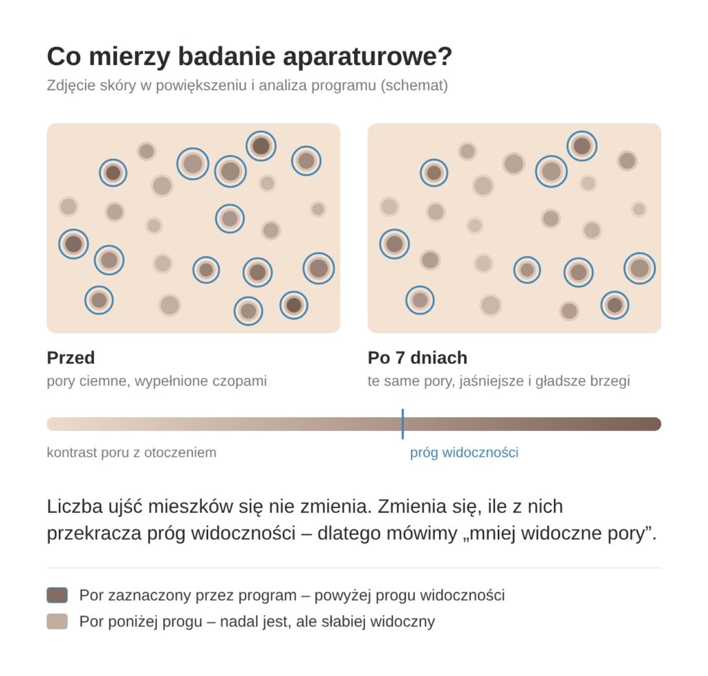 Badanie aparaturowe porów – próg widoczności przed i po oczyszczaniu