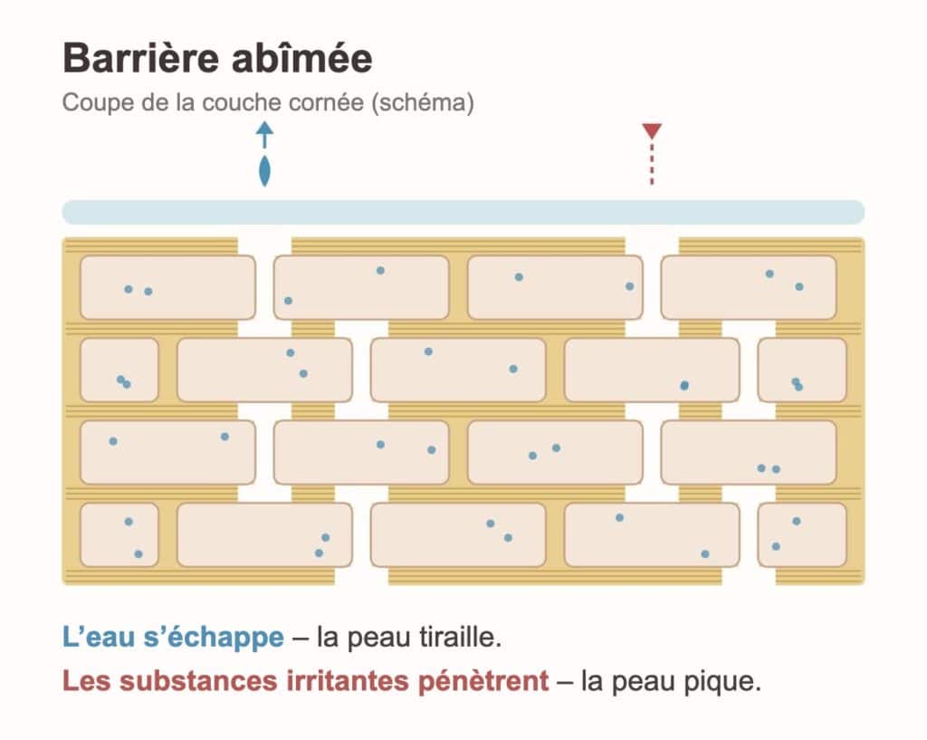 Barrière cutanée abîmée – schéma : ciment lipidique discontinu, l’eau s’échappe, les irritants pénètrent