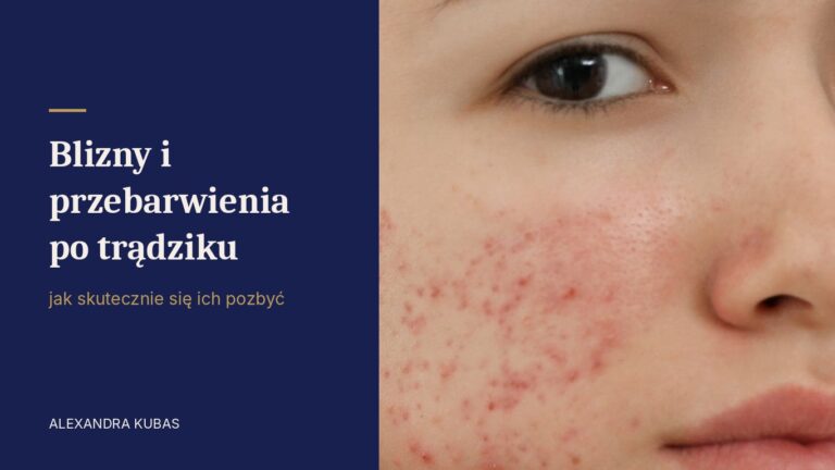Blizny i przebarwienia po trądziku na policzku
