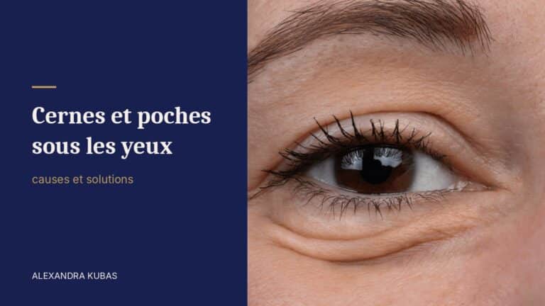 Cernes et poches sous les yeux - contour de l’œil en gros plan