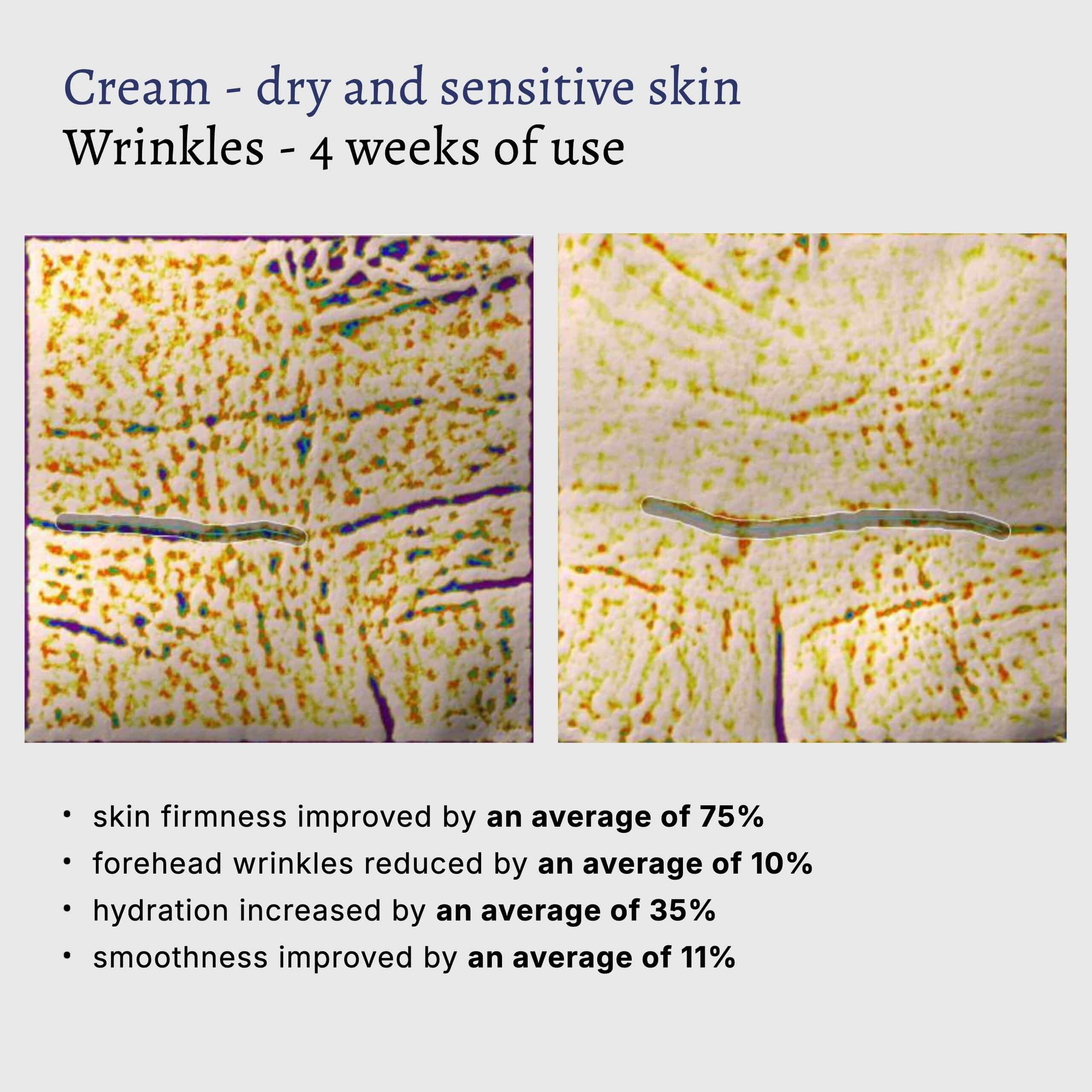 Pure Raw Rich Cream instrumental test on dry and sensitive skin: forehead wrinkles before and after 4 weeks