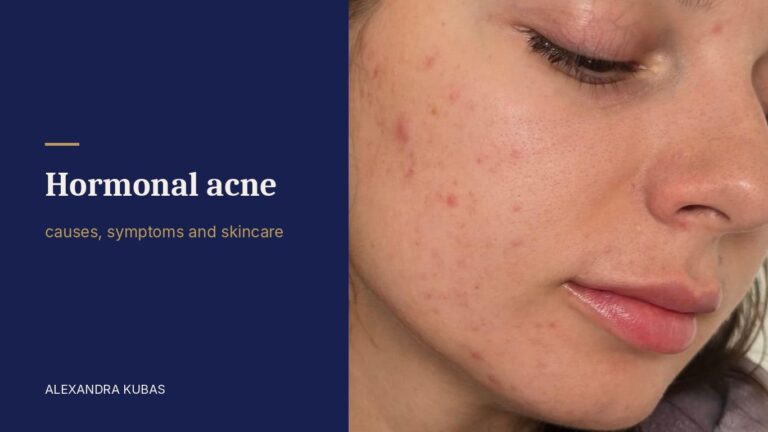 Hormonal acne - breakouts on the cheek and jaw