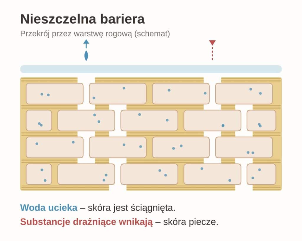 Nieszczelna bariera hydrolipidowa - schemat: przerwy w lipidowej zaprawie, woda ucieka, substancje drażniące wnikają