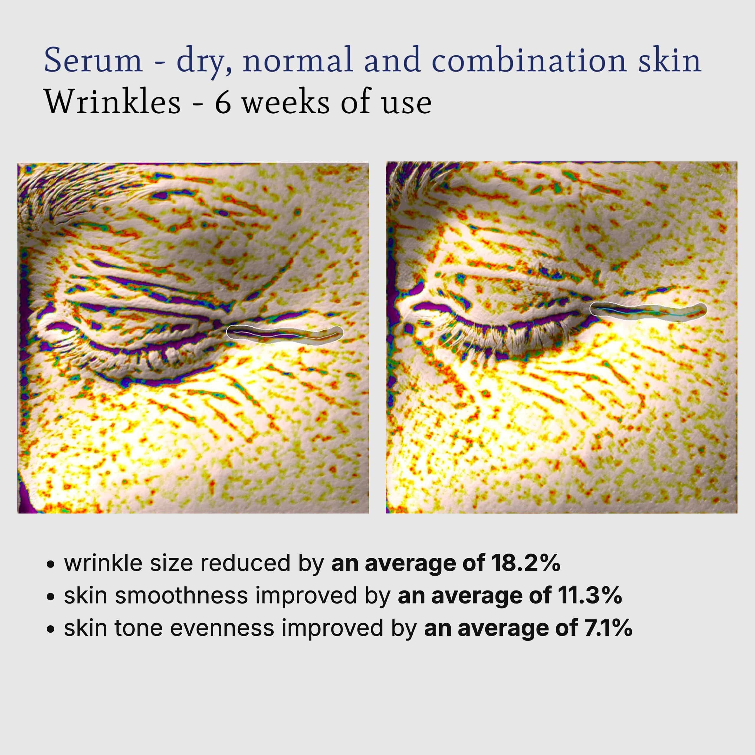 Serum + Q10 instrumental test on dry, normal and combination skin: wrinkles around the eye before and after 6 weeks