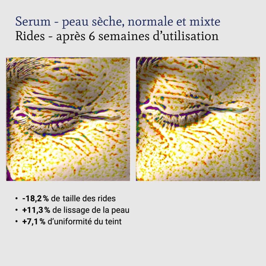 Sérum +Q10 : résultats du test instrumental après 6 semaines – taille des rides, lissage et uniformité du teint