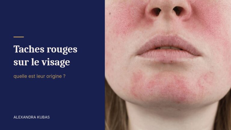 Taches rouges sur le visage - rougeurs sur les joues et le menton