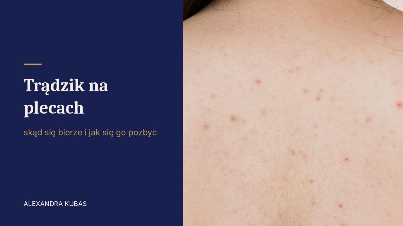Trądzik na plecach - zmiany trądzikowe na skórze pleców