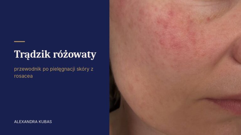Trądzik różowaty - rumień na policzku