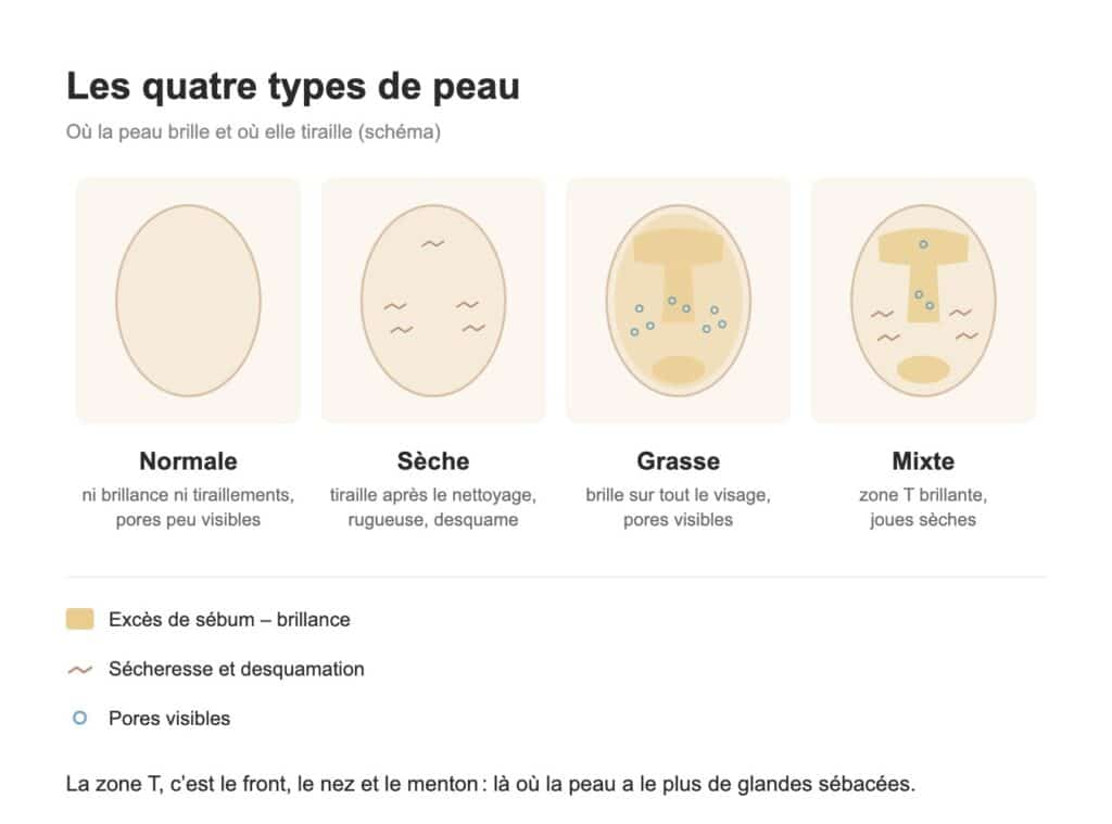 Schéma des quatre types de peau : normale, sèche, grasse et mixte