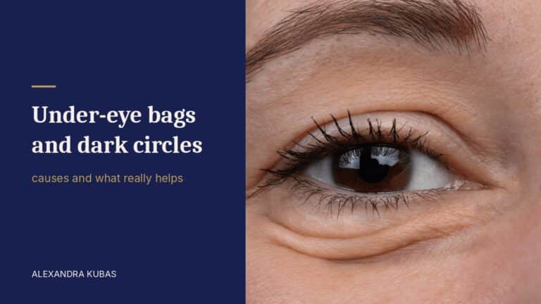 Under-eye bags and dark circles - close-up of a puffy under-eye area